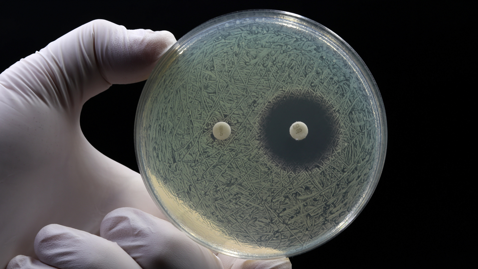 Antibiotic resistance