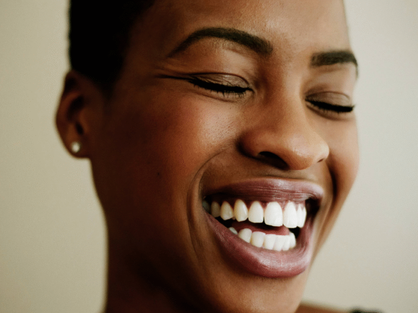 no prep veneers