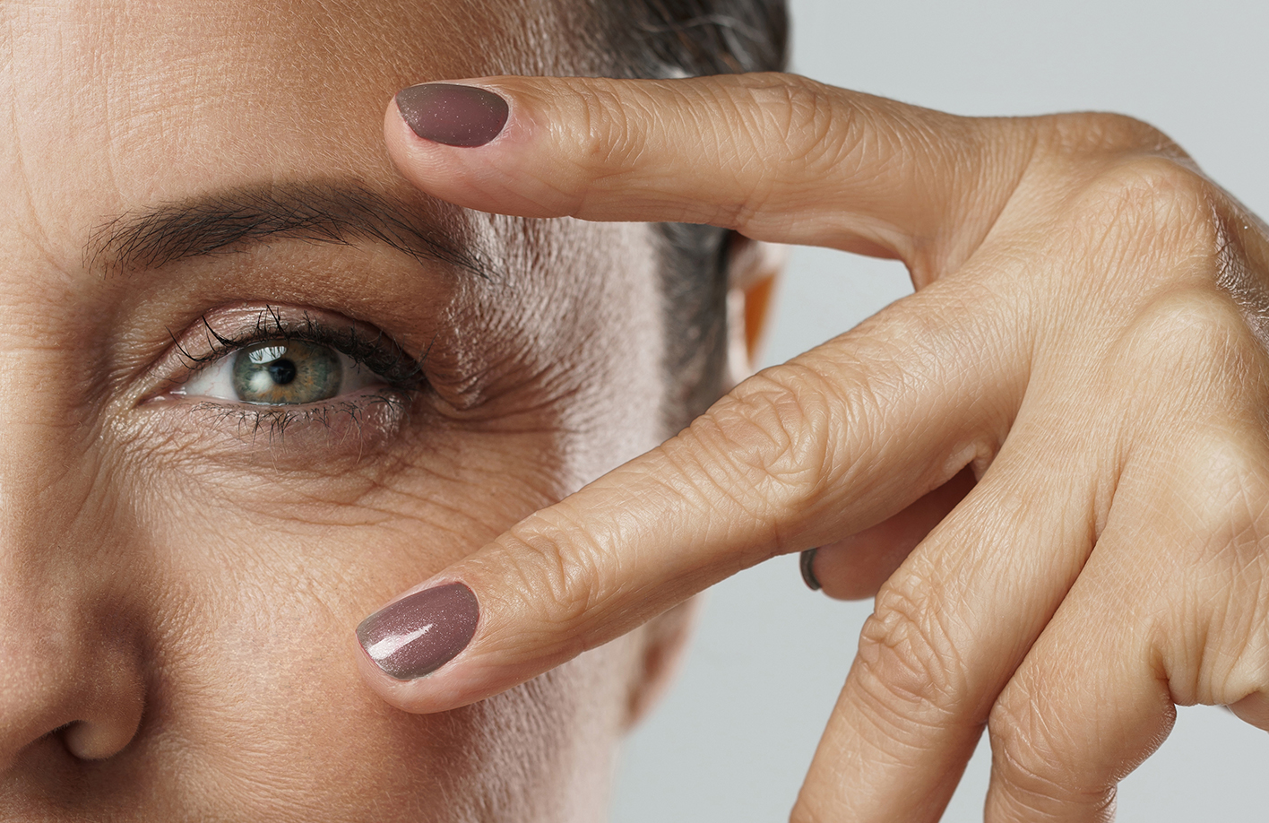 facial filler for under eye bags
