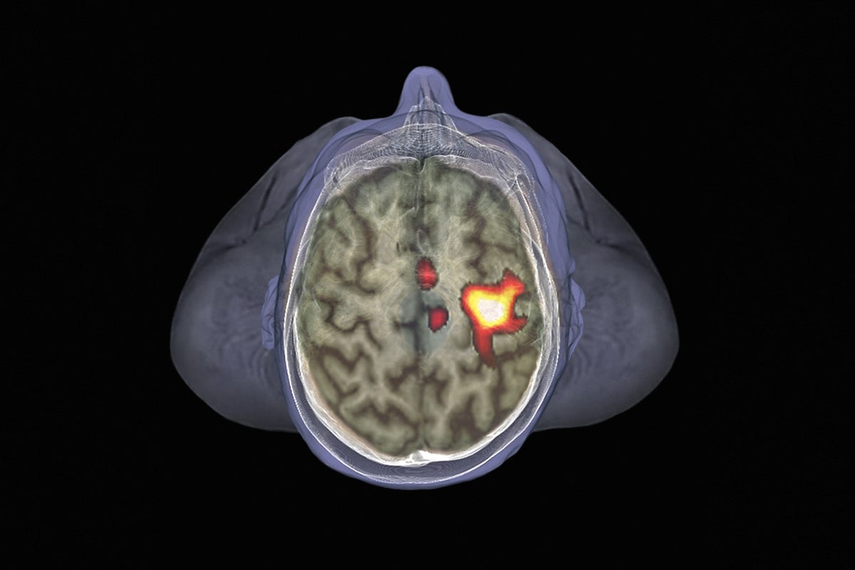 healthy brain fmri scan
