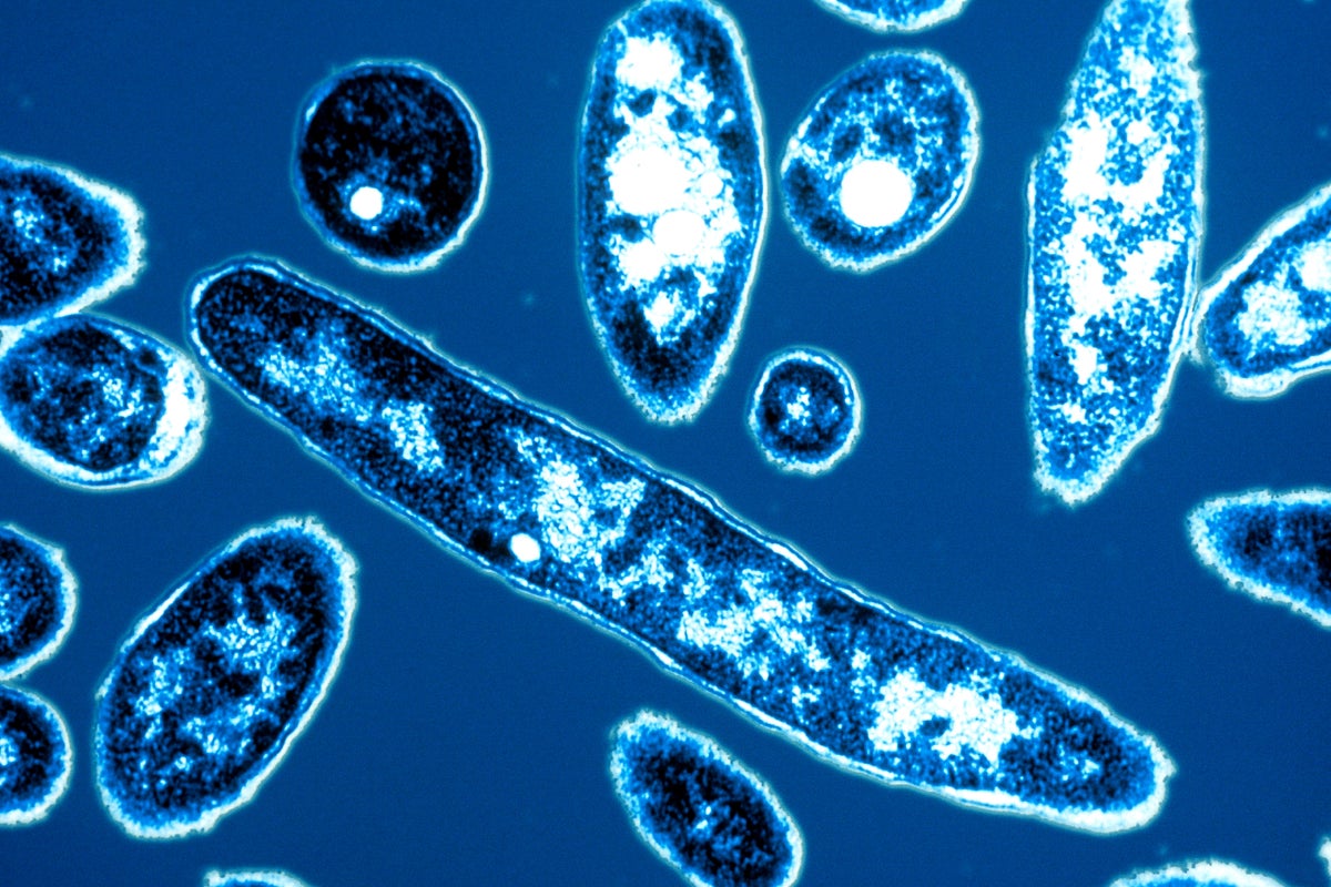 legionella pheumophia legionnaires disease under microscope