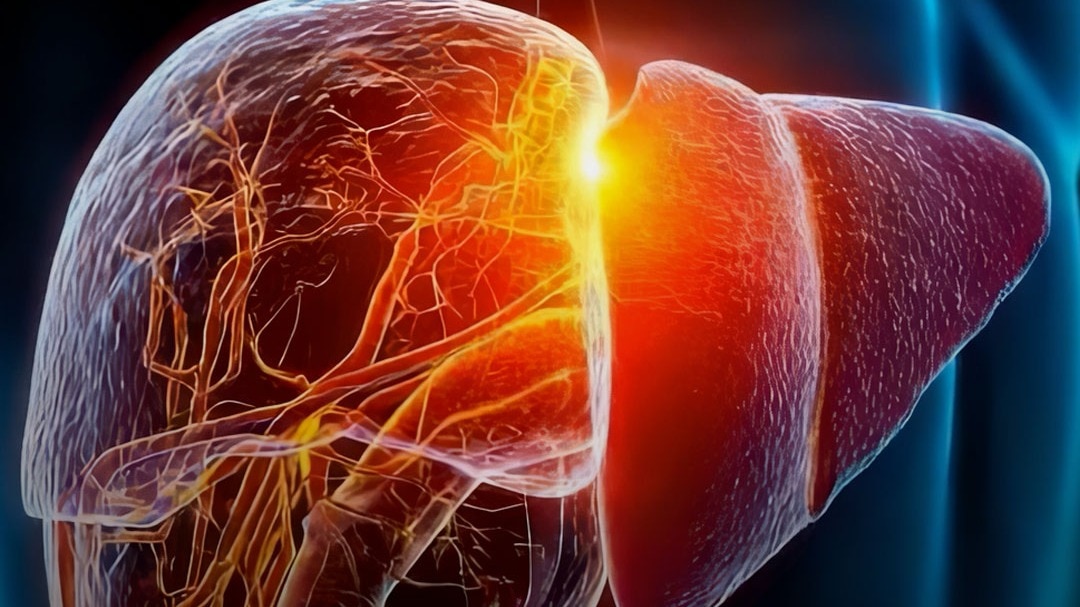 698f462f94018 fatty liver 134129813