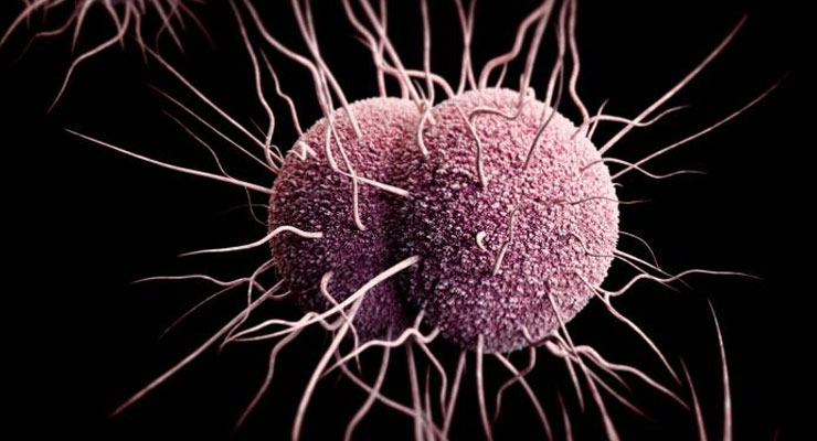 gonorrhea featured