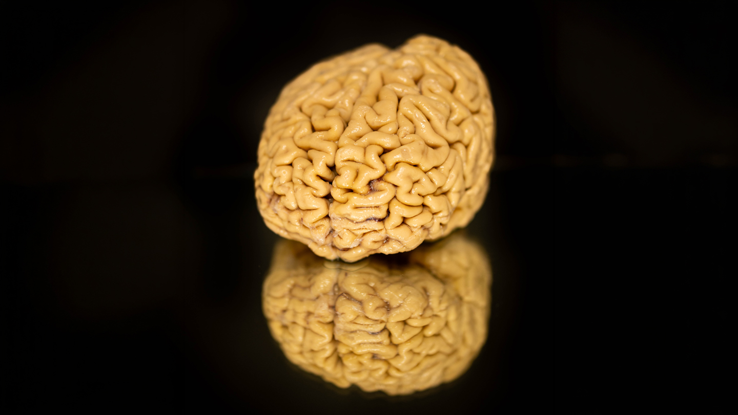 030326 LS SuperAger main