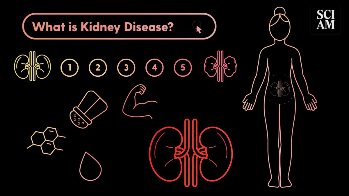 2026 kidneydisease decoded