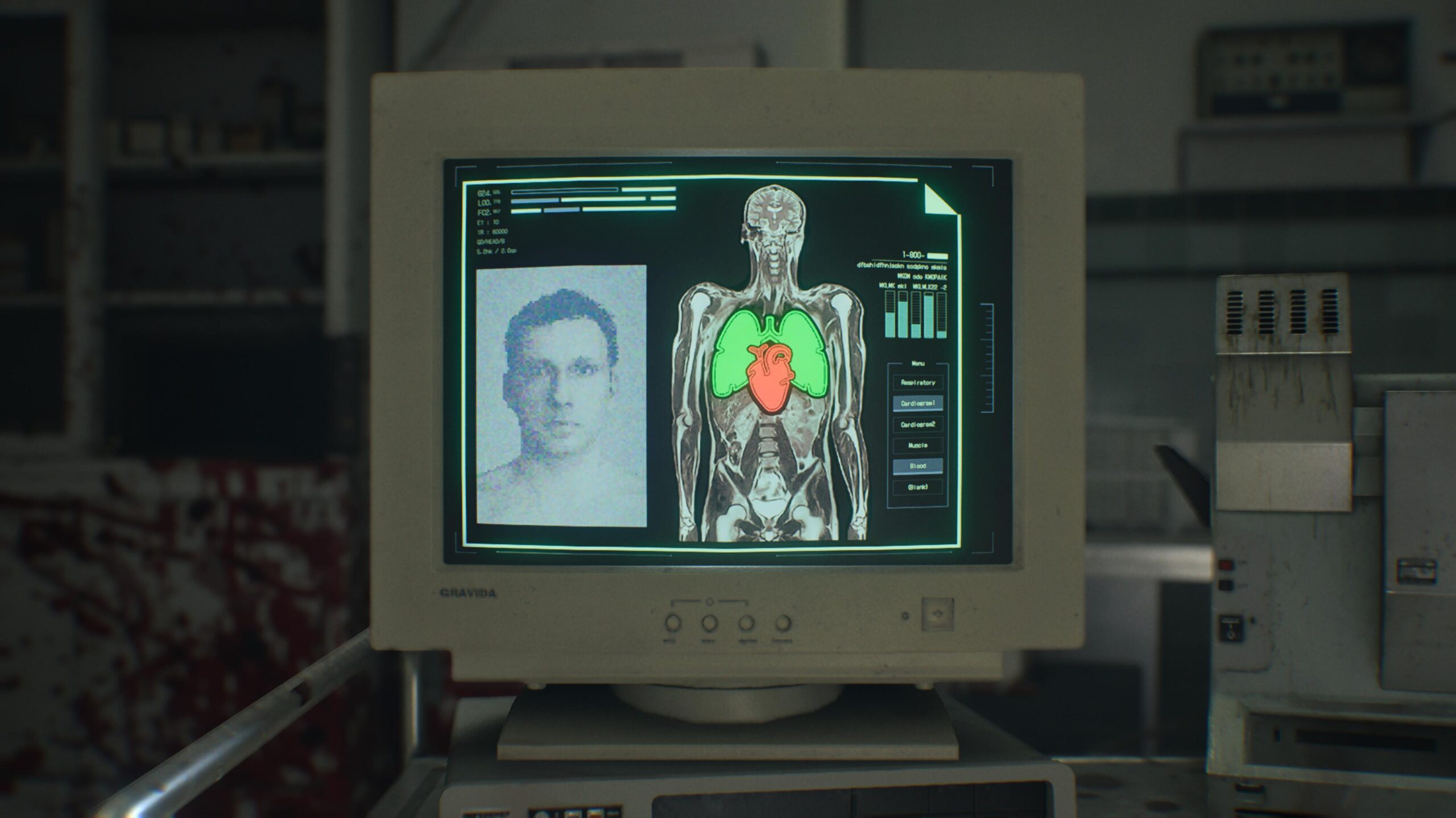 RESIDENT EVIL requiem 20260302162406 scaled