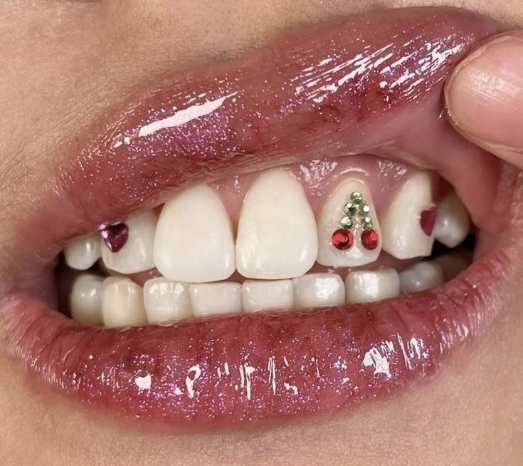 كرستالات الأسنان بين الترند الجمالي والجدل حول المبالغة والآثار الصحية – أخبار السعودية