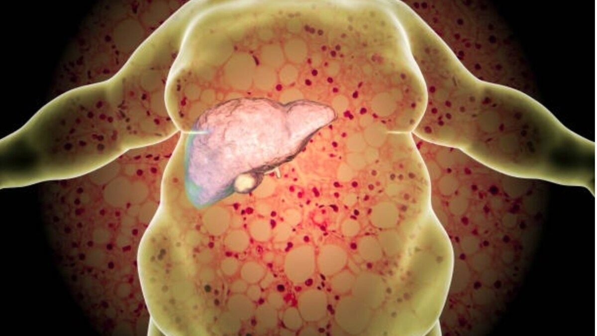 69de19c89e7a6 foods for liver health 275507701