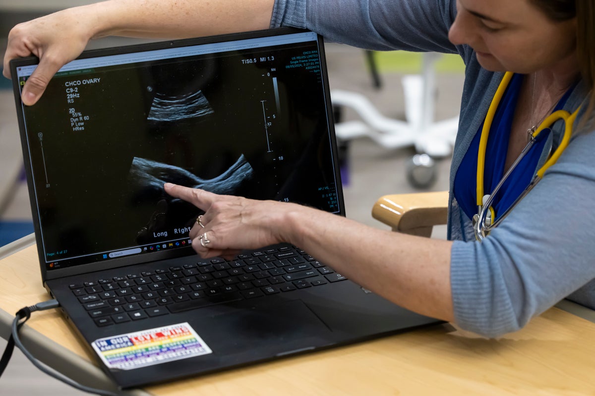 GettyImages 2241106538 resized