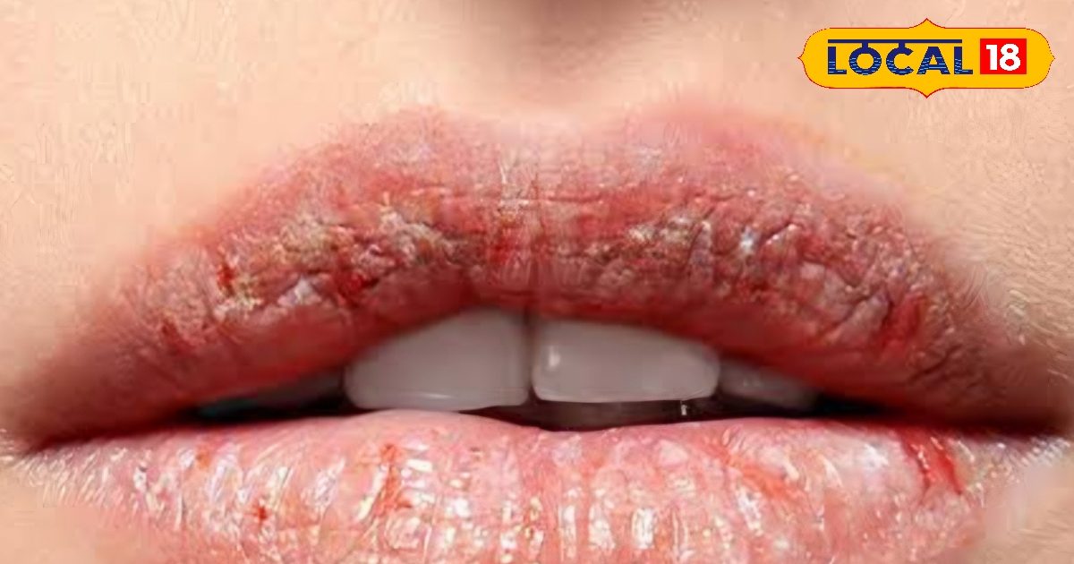 HYP 5827129 cropped 16042026 085555 screenshot 20260416 082334 2