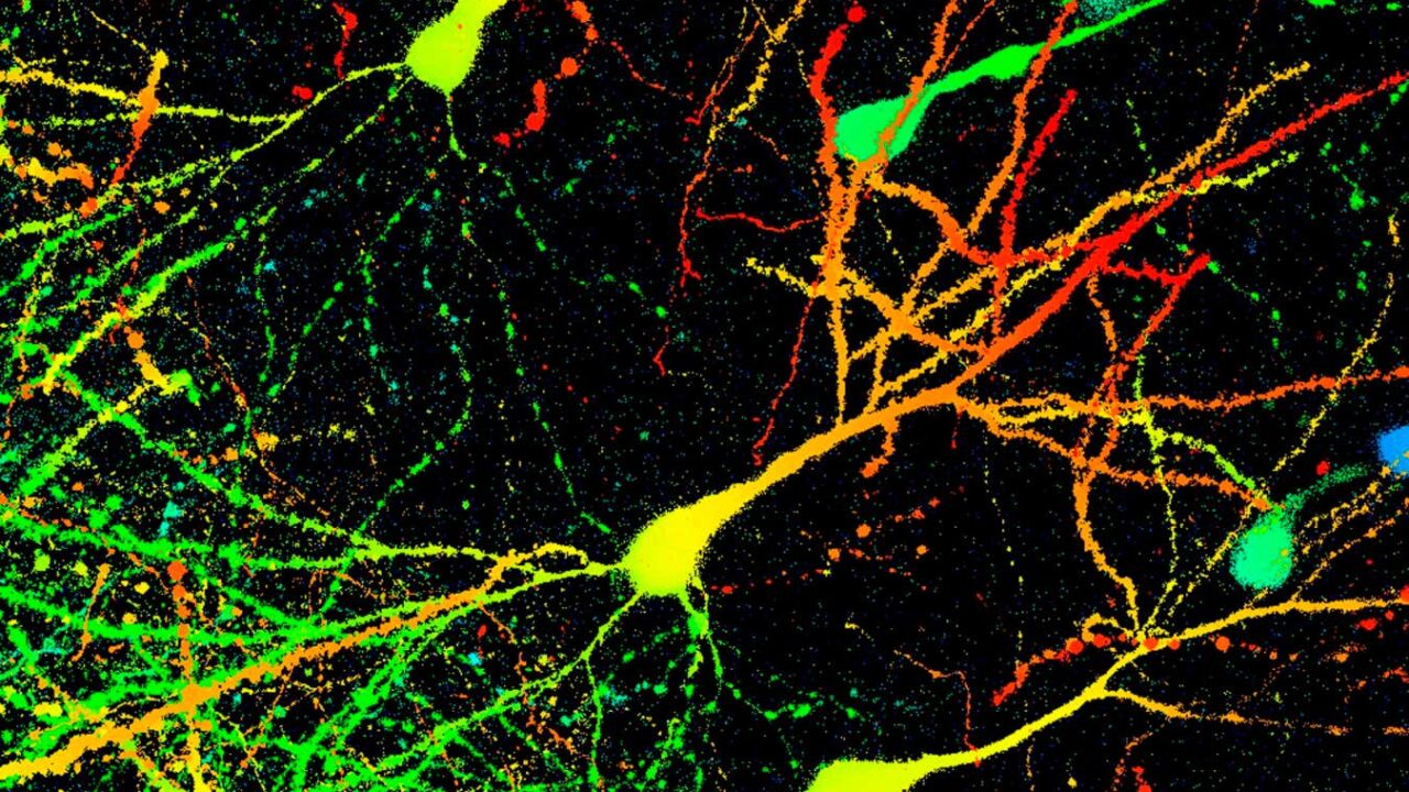 Mysterious ‘compound X’ clears toxic Parkinson’s proteins from brain