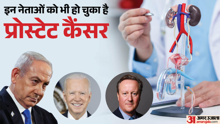 prostate cancer da770efb11bdaf51c3b7a4cb7809339b