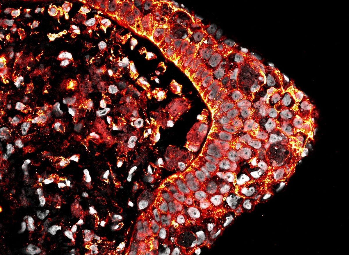 regenerating tadpole limb