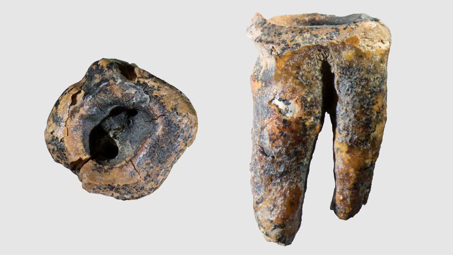 051326 TM neandertal neandertaldentistry