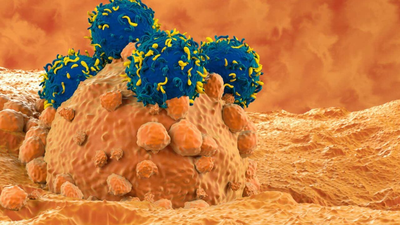 CAR T-cell therapy bolstered by stiffening up cancer cells first